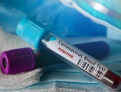 7 Gejala Corona Dikaitkan dengan Infeksi Varian Baru dari Inggris