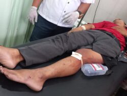 Laka Lantas Dijalan Raya Mantang, Dua Pengendara Mengalami Patah Tulang, Polisi Lakukan Olah TKP