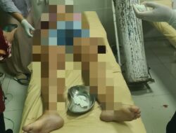 Warga Negara Asing Asal Norwegia Meninggal Akibat Laka Lantas Tunggal di Kuta*