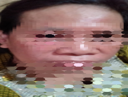 Pelaku Penganiayaan masih bebas,Pelayanan Polsek Rappocini Dinilai lambat